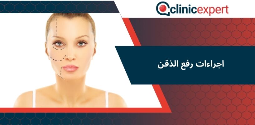 bichectomy - اجراءات رفع الذقن