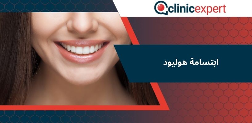 ابتسامة هوليود