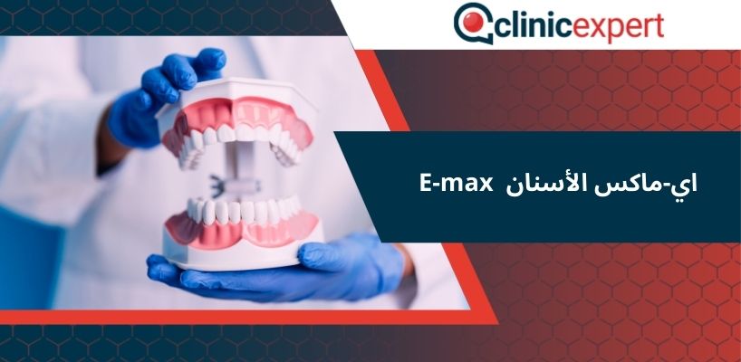  اي-ماكس الأسنان E-max