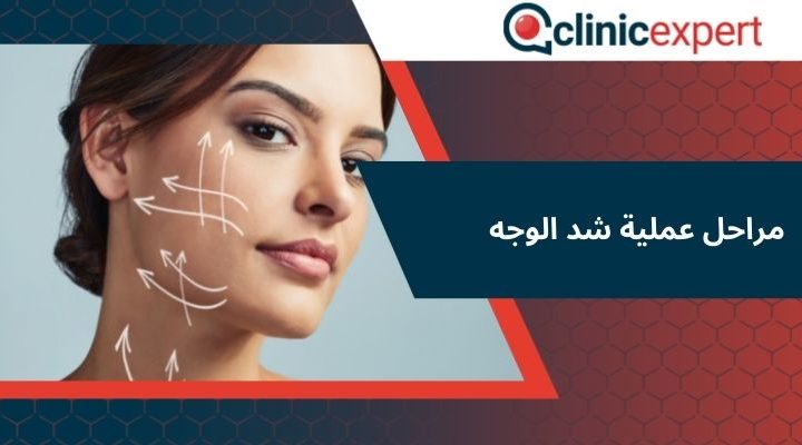 مراحل عملية شد الوجه