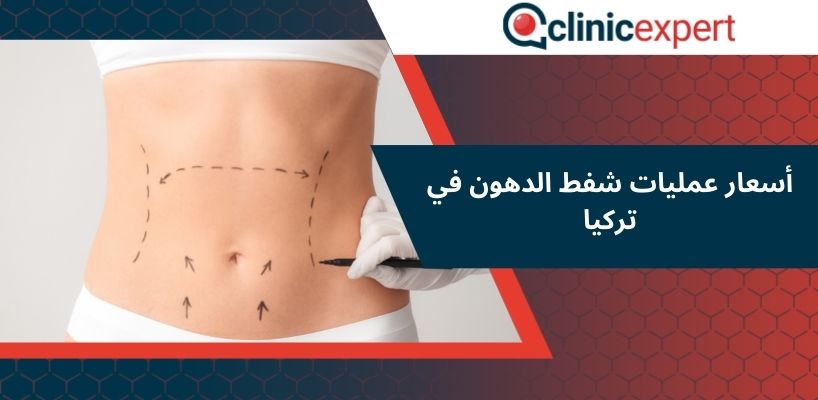 أسعار عمليات شفط الدهون في تركيا