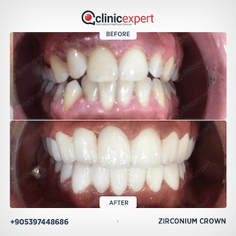 Dentistry Patients