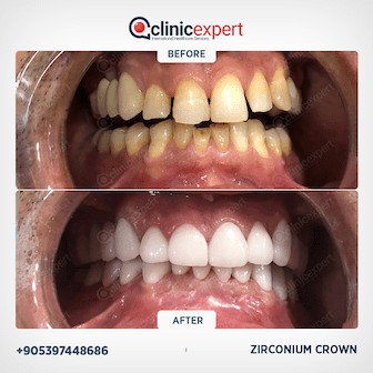 Dentistry Patients