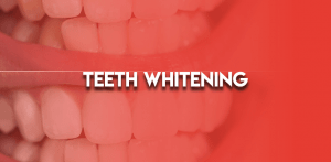 Teeth Whitening