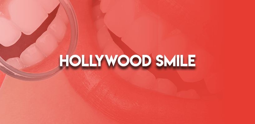 Hollywood Smile in turkey