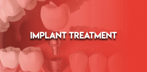 Implant Treatment