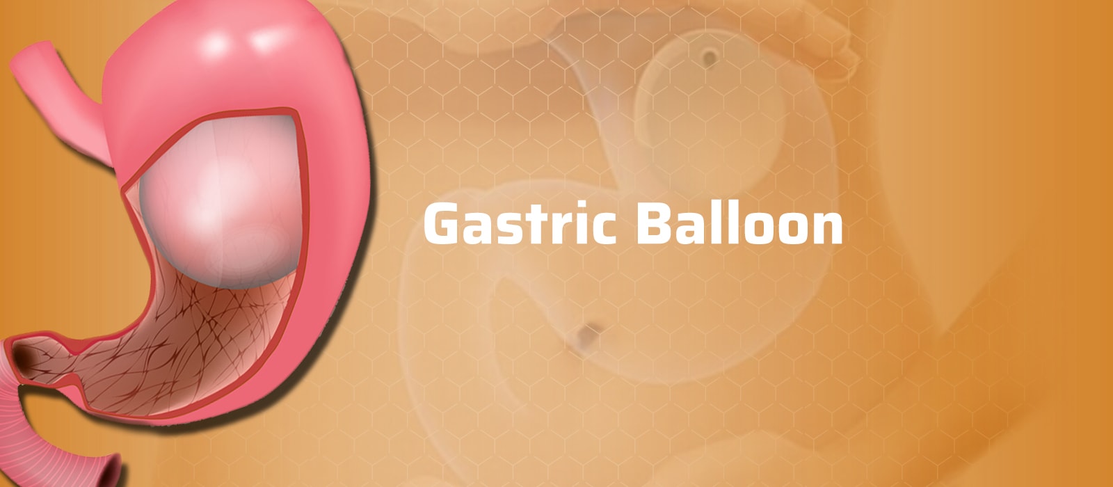 Gastric Balloon Turkey