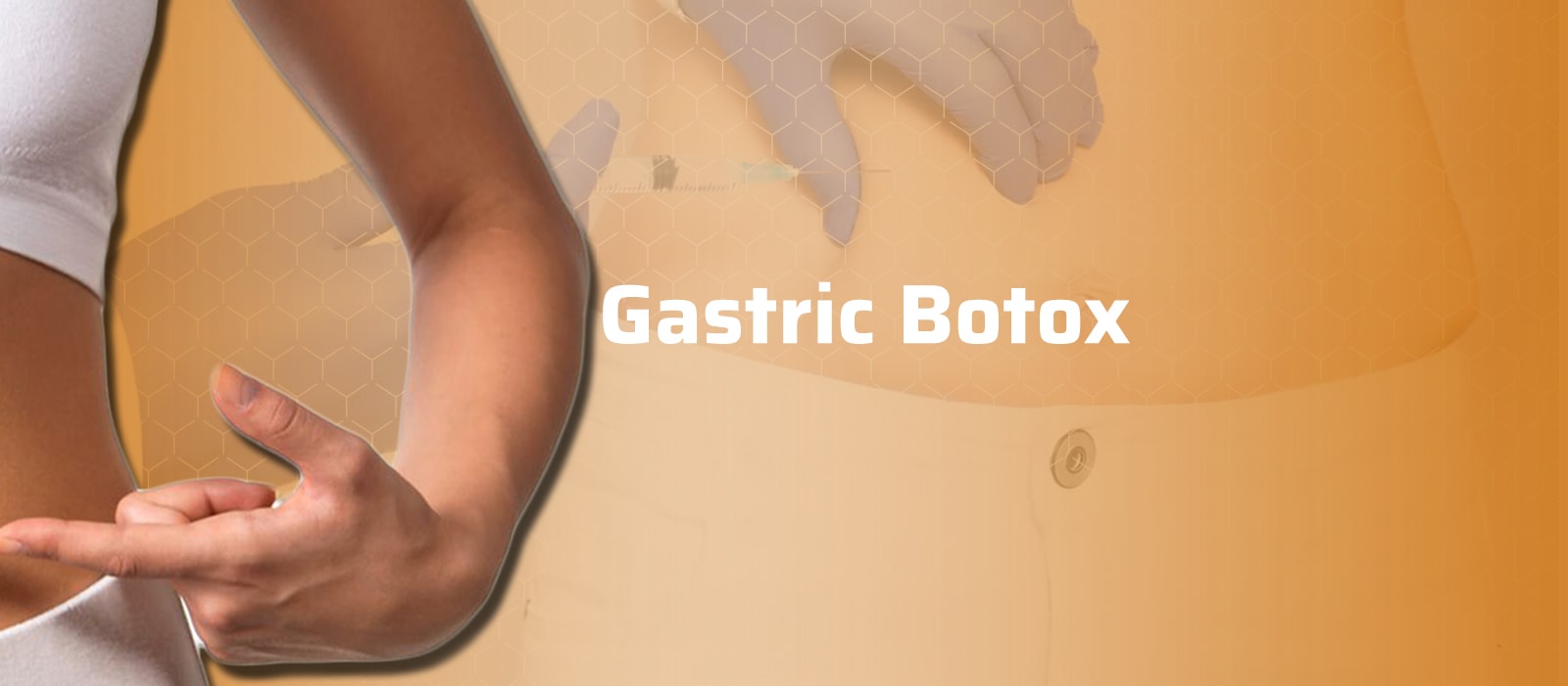 Gastric Botox