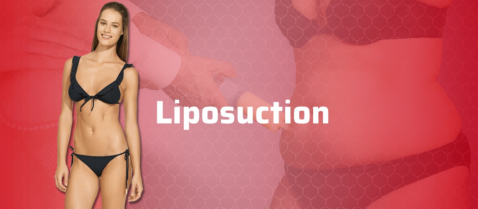 liposuction clinic