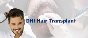 DHI hair transplant