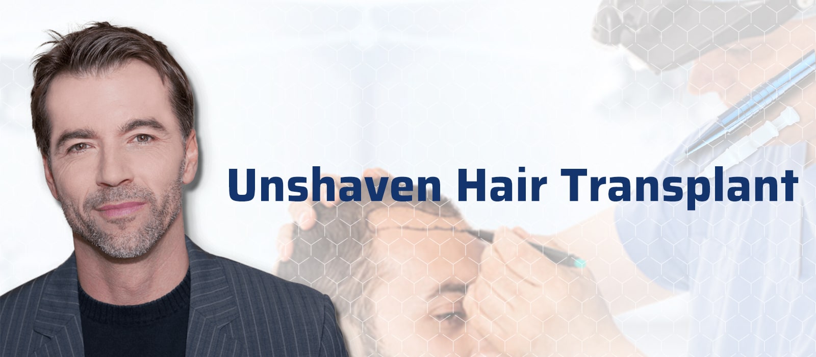 Unshaven hair transplant