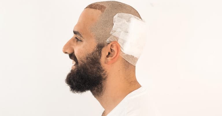 Hair Transplant Aftercare