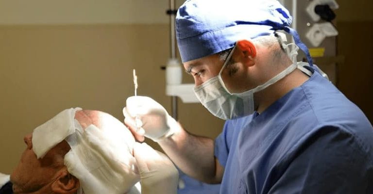 Best Hair Transplant Doctors