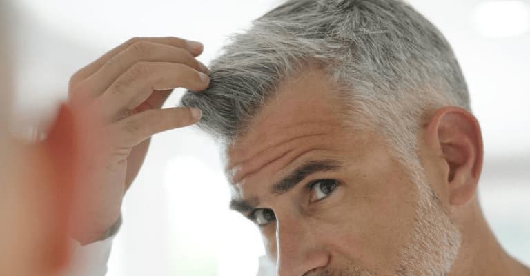 Hair Transplantation Results