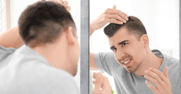 What Is the Best Age for Hair Transplant?