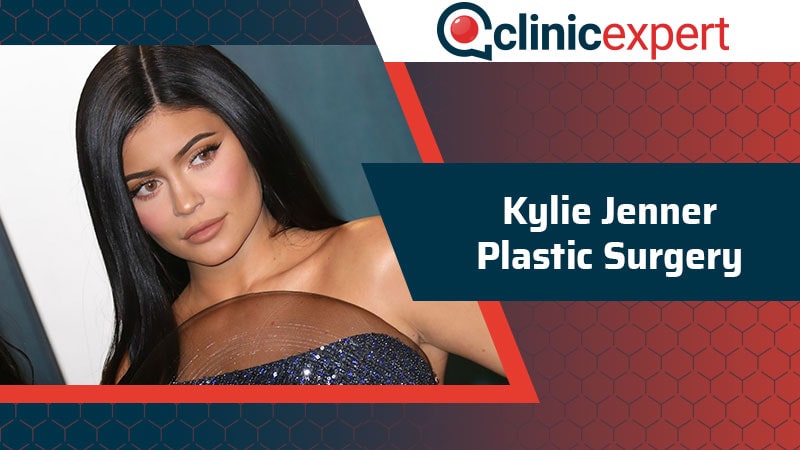 Kylie Jenner Plastic Surgery