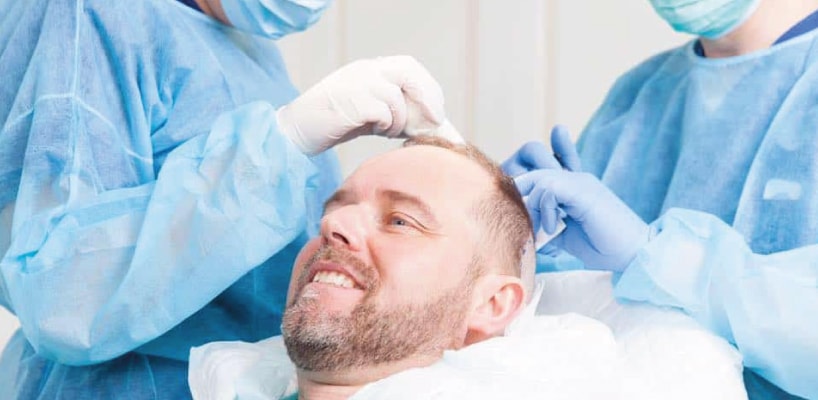 Hair Transplants Alpharetta (Atlanta) Georgia - Steve Latham Hair  Restoration Clinic Huntsville Alabama