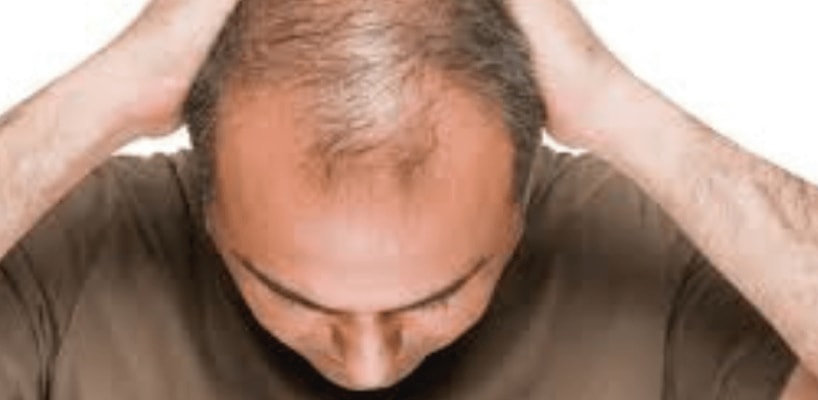 Hair Growth Surgery