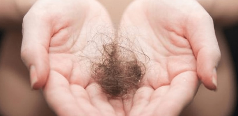 How Much Hair Loss is Normal