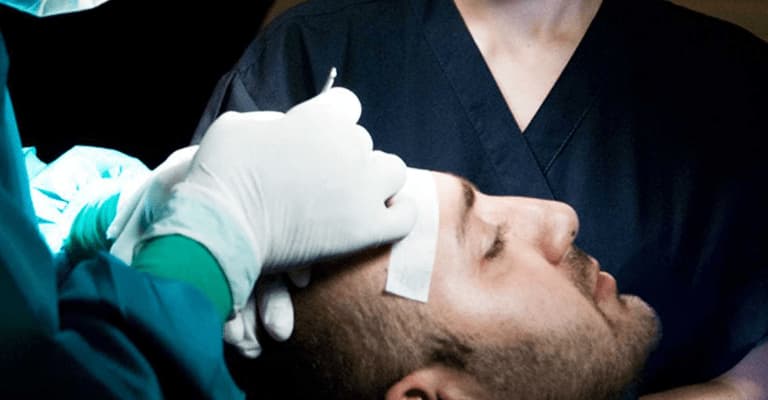 How to Find a Good Hair Transplant Surgeon?How to Find a Good Hair Transplant Surgeon?
