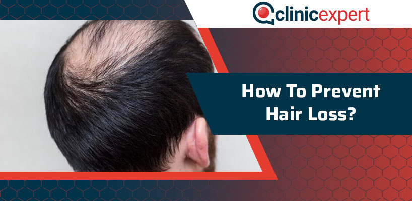 How to Prevent Hair Loss?