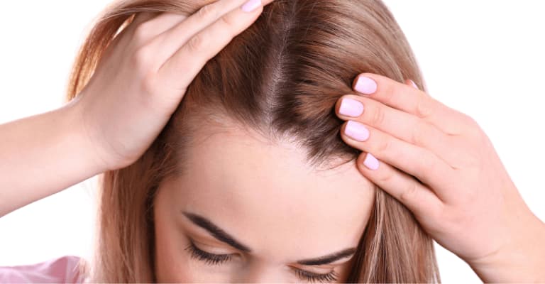 What Causes Hair Loss in Women?