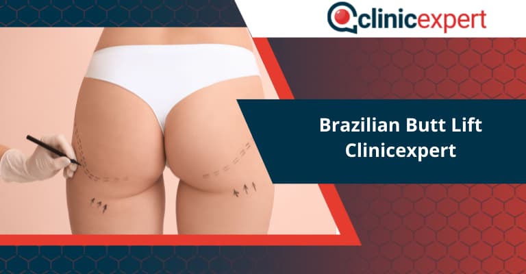 Brazilian Butt Lift