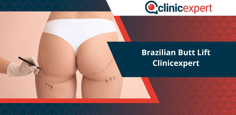 Brazilian Butt Lift Clinicexpert