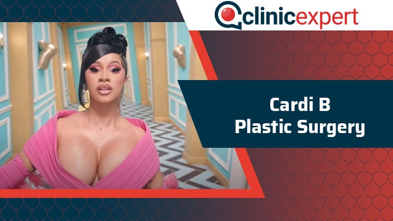 Cardi B Plastic Surgery