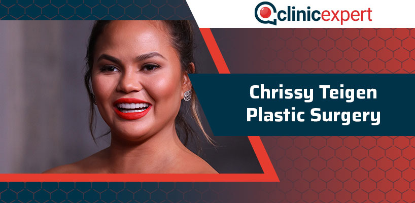 Chrissy Teigen Plastic Surgery