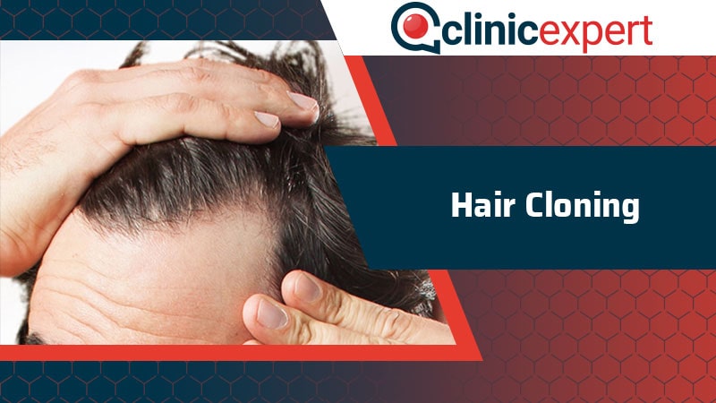Hair Cloning | ClinicExpert