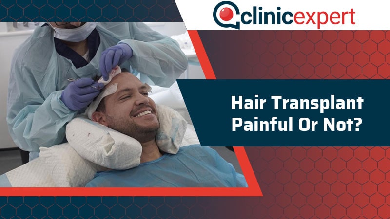 Hair Transplant Painful or Not?