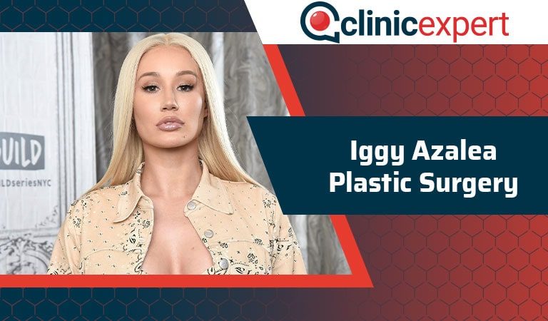 Iggy Azalea Plastic Surgery
