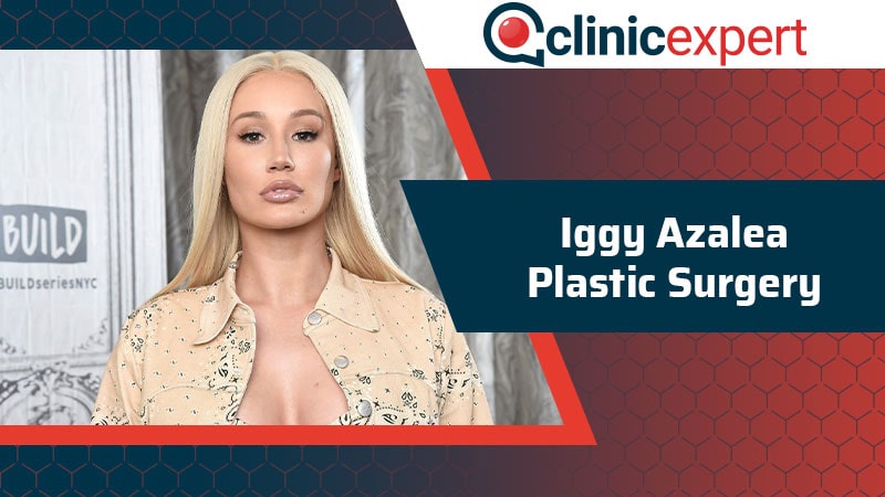 Iggy Azalea Plastic Surgery