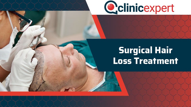 Surgical Hair Loss Treatment