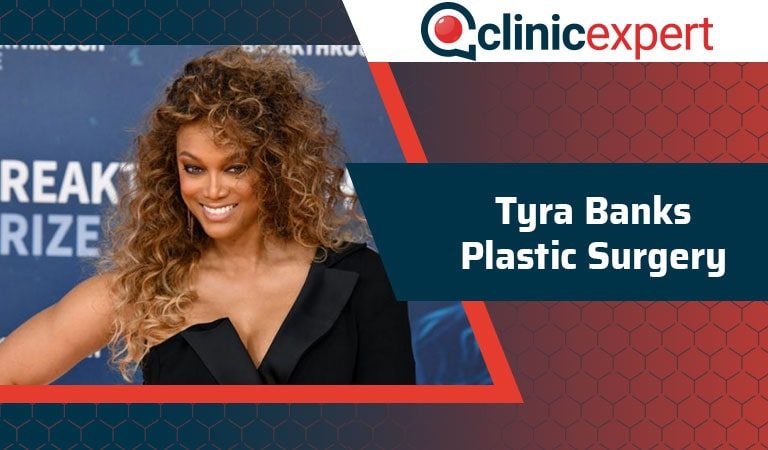 Tyra Banks Plastic Surgery
