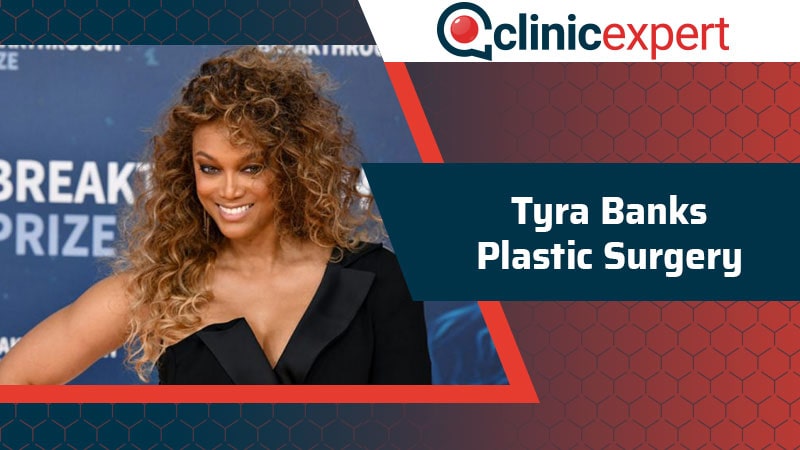 Tyra Banks Plastic Surgery