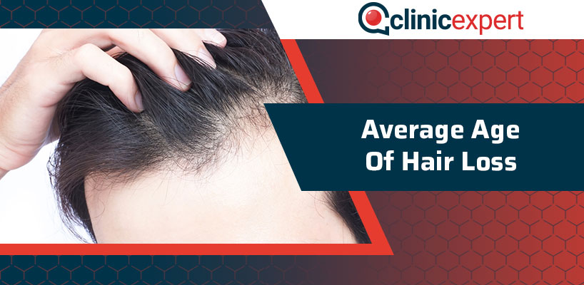 Average Age Of Hair Loss