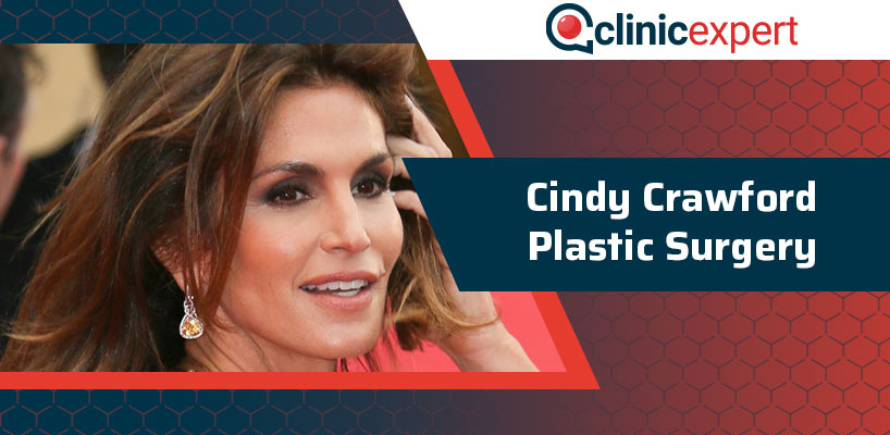 Cindy Crawford Plastic Surgery