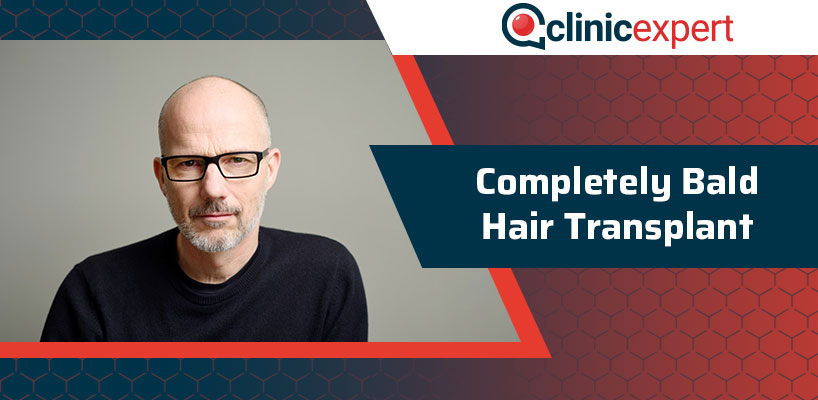 Completely Bald Hair Transplant