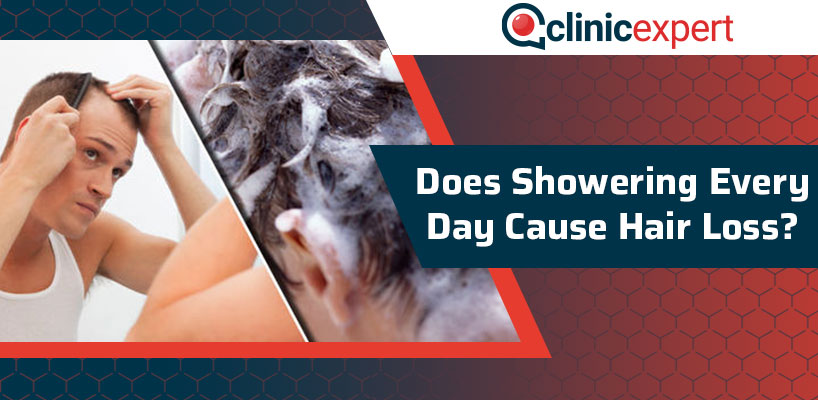 Does Showering Every Day Cause Hair Loss?