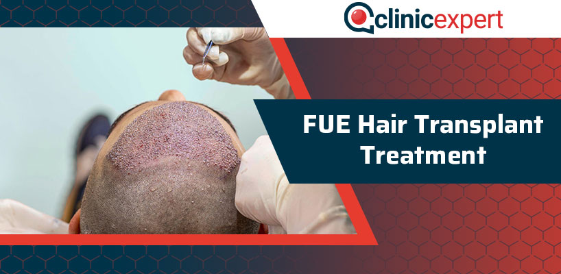 FUE Hair Transplant Treatment