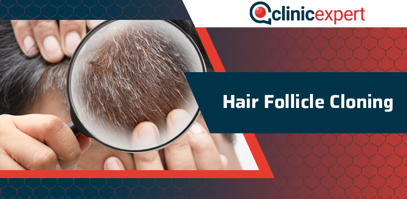 Hair Follicle Cloning