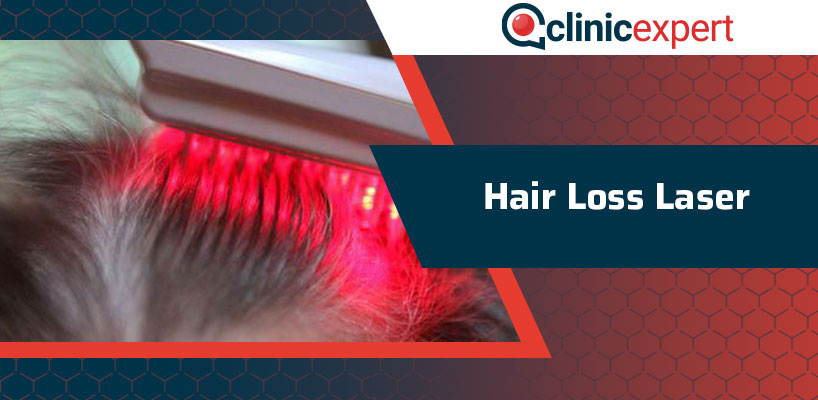 Hair Loss Laser