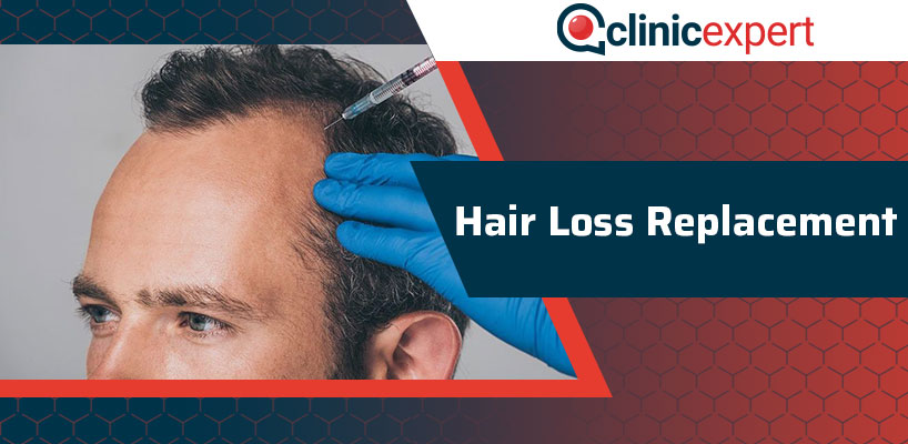 Hair Loss Replacement