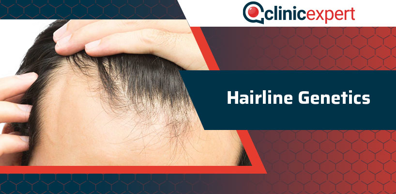 Hairline Genetics | ClinicExpert