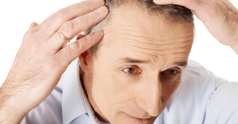 How Effective Is Hair Transplant?