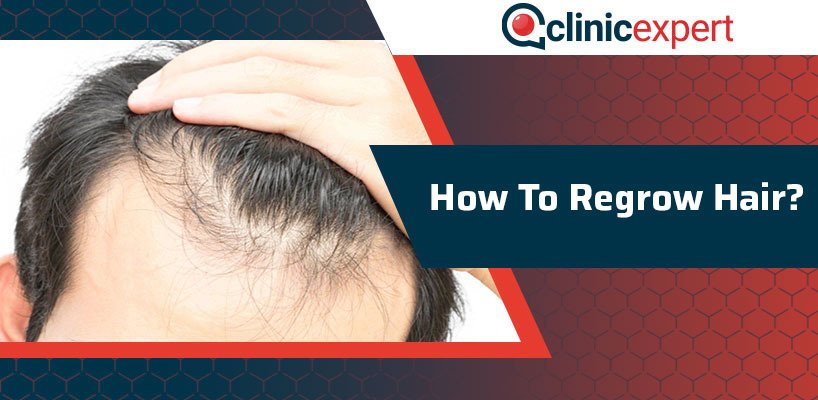 How To Regrow Hair Clinicexpert