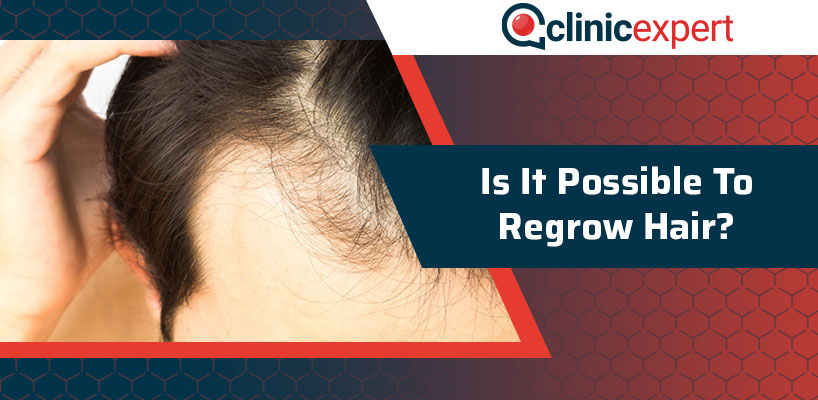 Is It Possible to Regrow Hair?