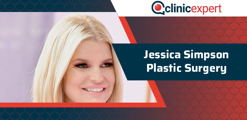 Jessica Simpson Plastic Surgery